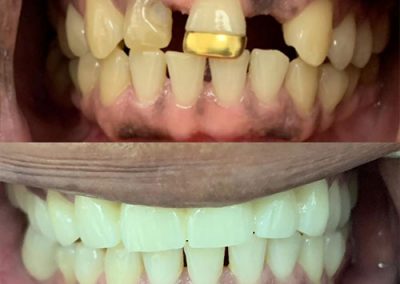 Prosthodontic