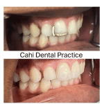 Children&rsquo;s Dentist Johannesburg,Pediatric Dentist Parktown North,Children&rsquo;s Dental Care Johannesburg,Best Children&rsquo;s Dentist Johannesburg,Dental Care for Kids Parktown North